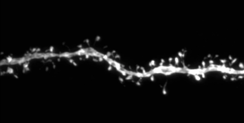Scientists discover unexpected link between genes involved in human brain evolution and developmental disorders